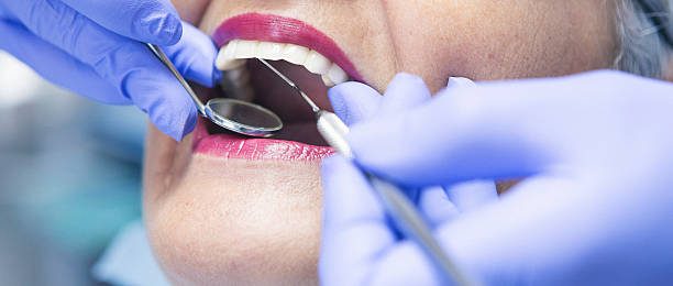 Best Emergency Treatment for Dental Infections or Abscesses in Yuc Valley, CA